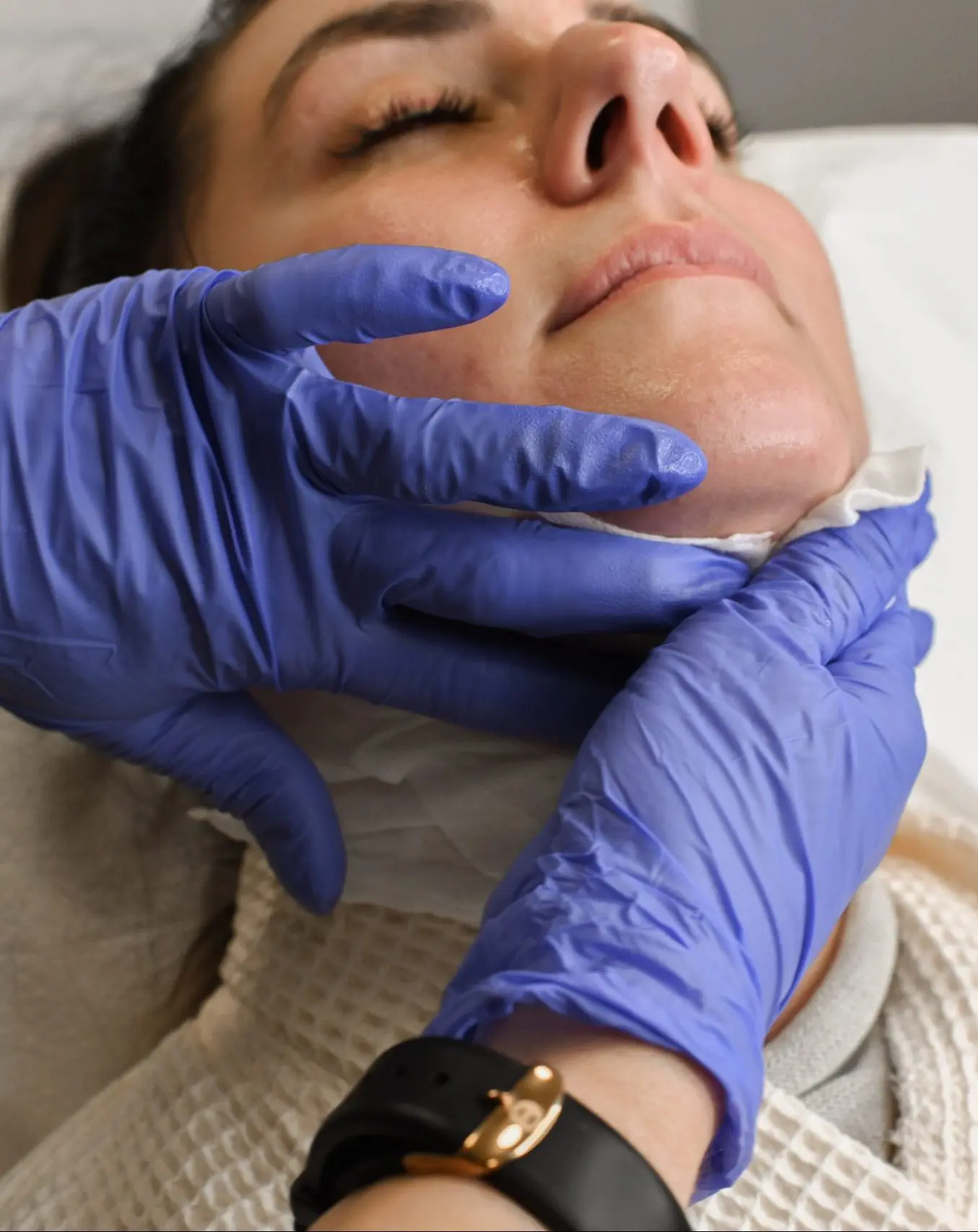 KYBELLA® treatment at BodyLase