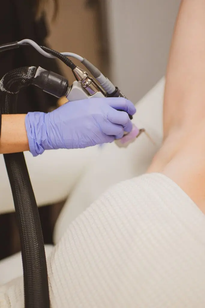 BodyLase Laser Hair Removal 4 Female patient receiving laser hair removal treatments at BodyLase
