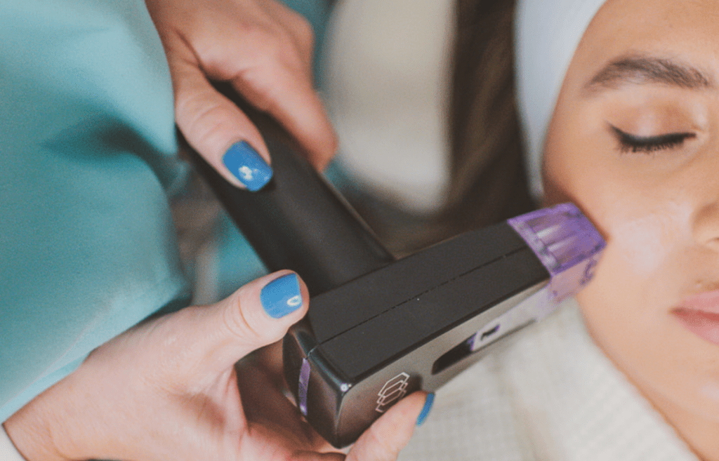 Morepheus8 consultation