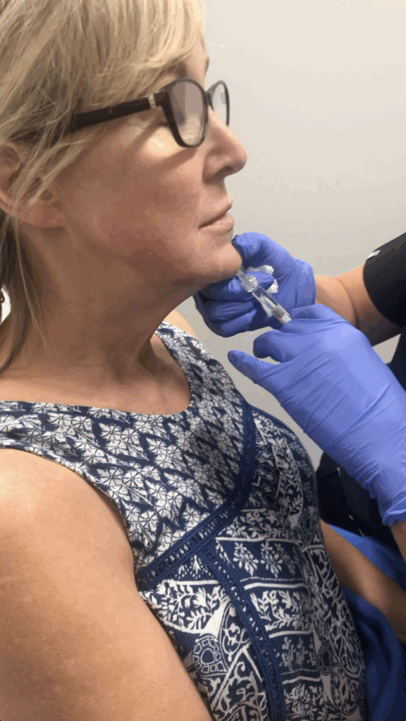 Dermal Fillers