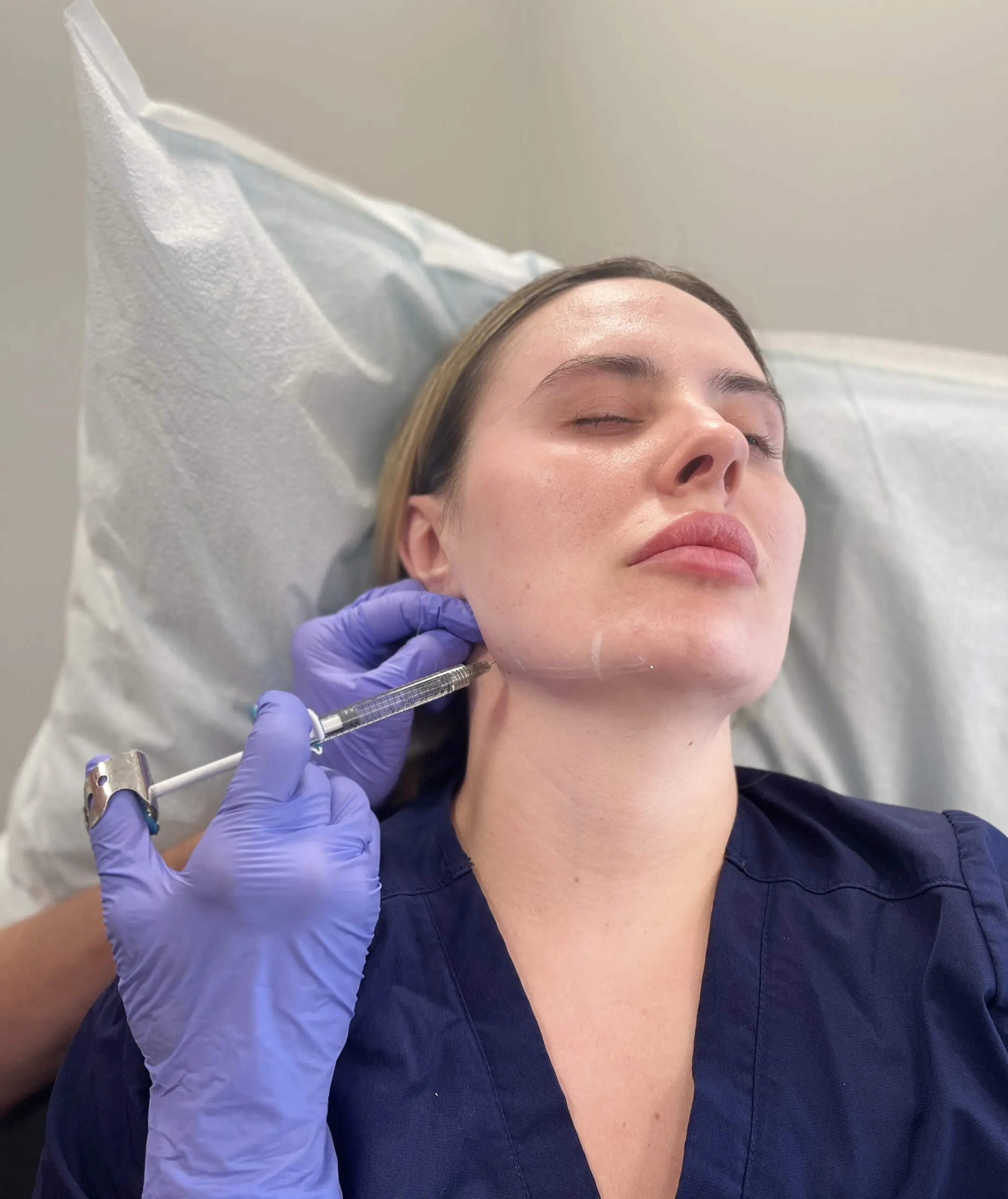 Dermal Filler