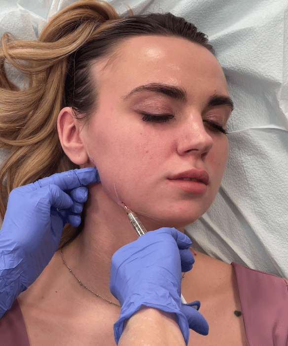 RHA Filler on a young lady