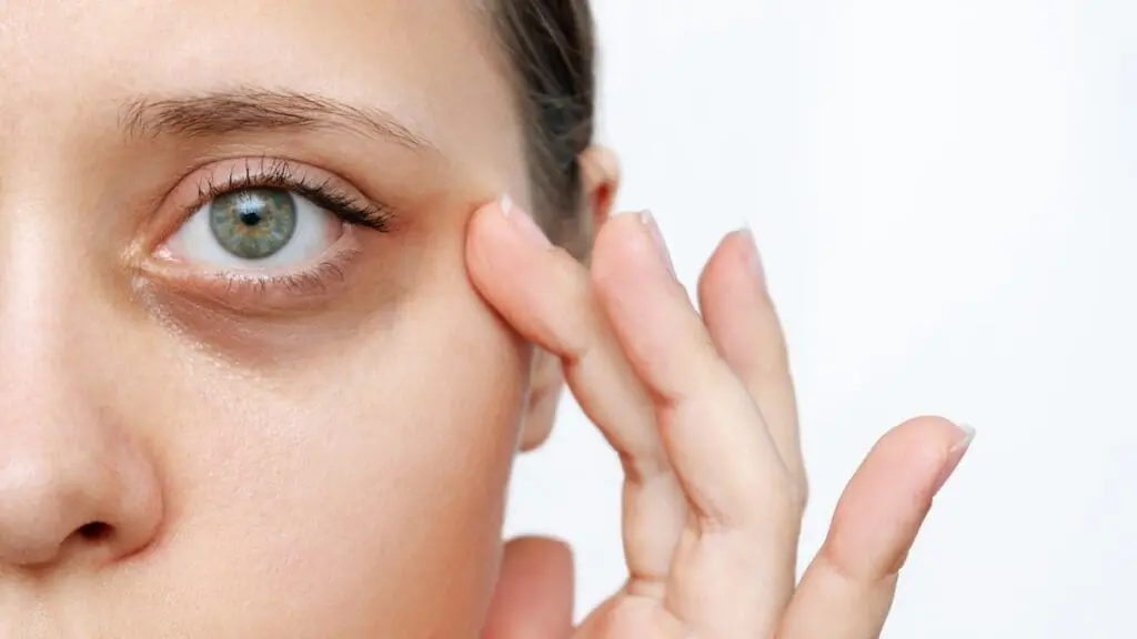 How to Get Rid of Dark Circles and Puffiness Under the Eyes 1 How To Remove Dark Circles Under Eyes
