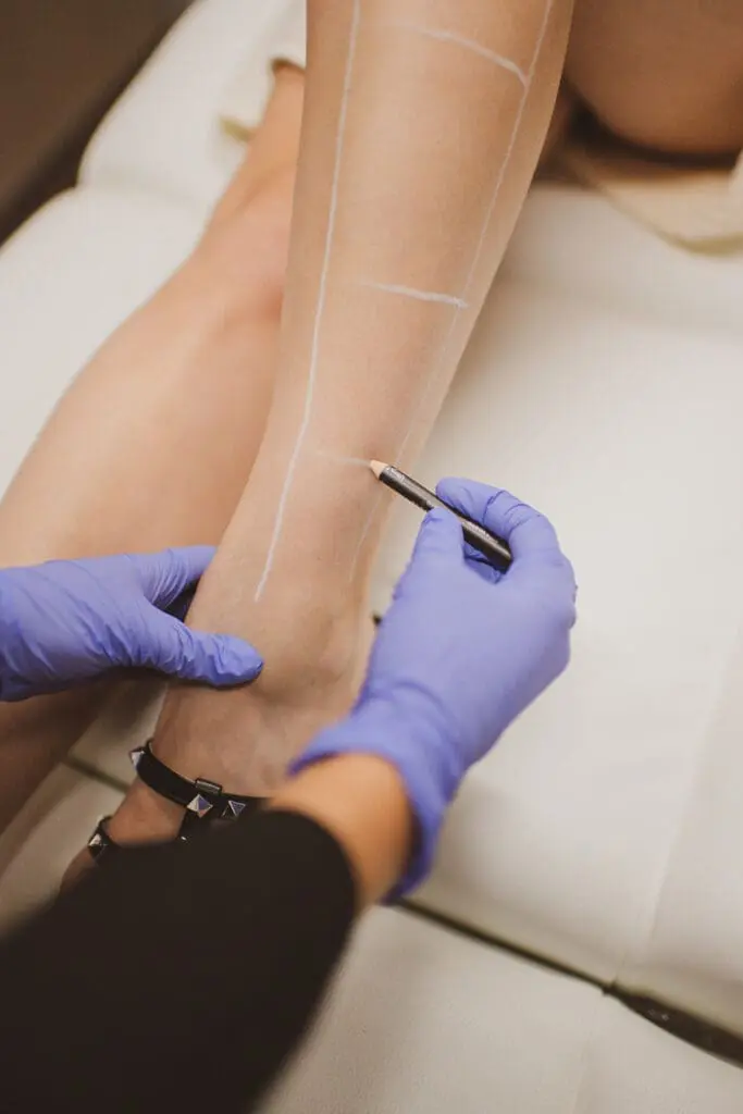 Laser Hair Removal in Raleigh, Cary, Chapel Hill, and Clayton, NC 2 laser hair removal