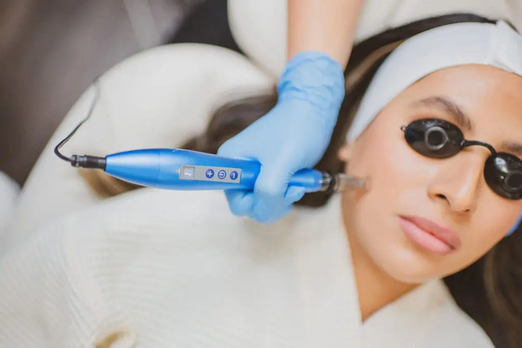 Microneedling