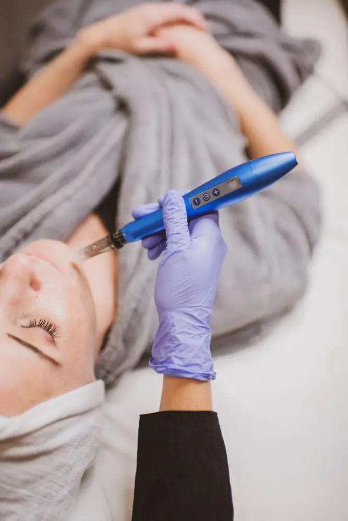 Microneedling in Raleigh, Cary, Chapel Hill, and Clayton, NC 2 Microneedling