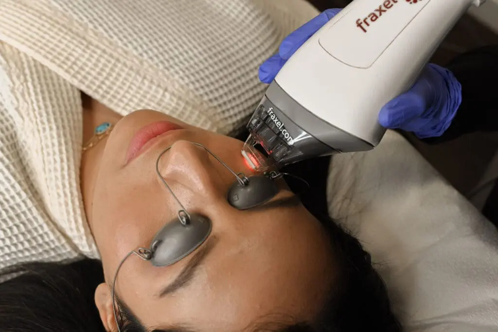 Anti-aging Treatments with Long Lasting Effects 1 Fraxel Laser Skin Resurfacing