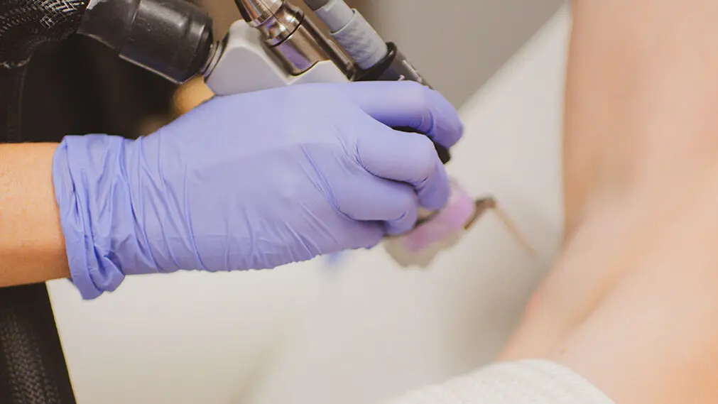 What is the Best Laser Hair Removal Machine? 1 Laser Hair Removal Raleigh