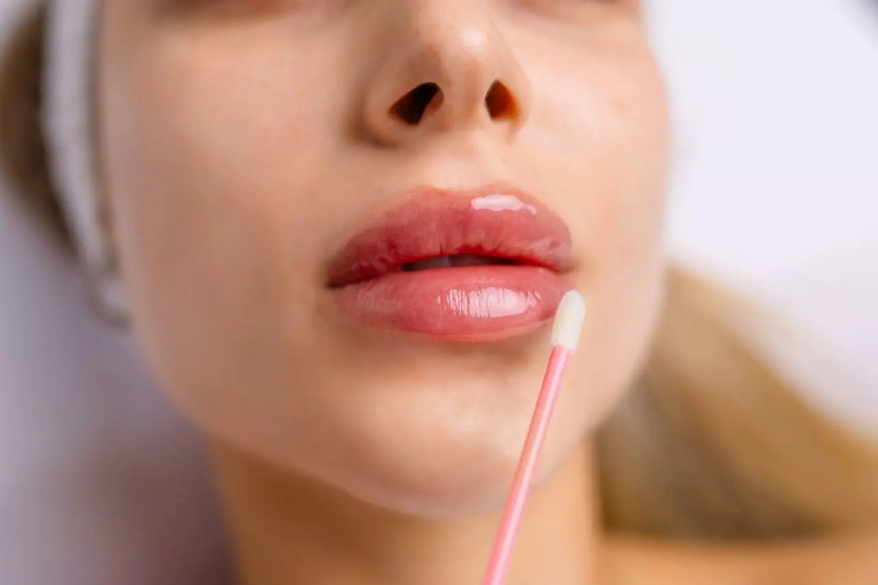 Lip Filler