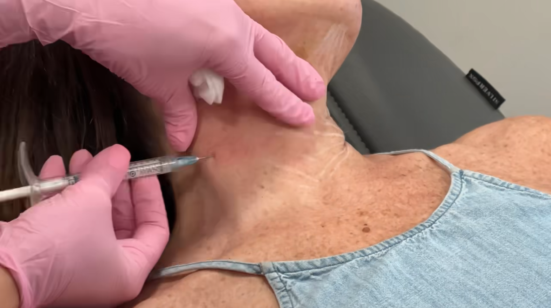 Hyperdilute Radiesse in Raleigh, Cary, Chapel Hill, and Clayton, NC 1 Hyperdilute Radiesse