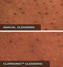 clarisonic cleansing benefit