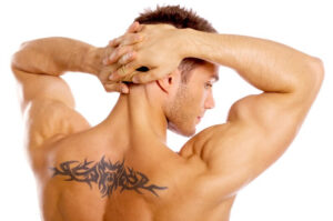 laser tattoo removal Raleigh