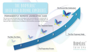 Laser hair removal graph | bodylase®