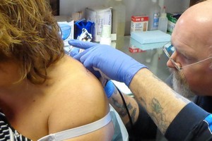 Laser tattoo removal | bodylase®