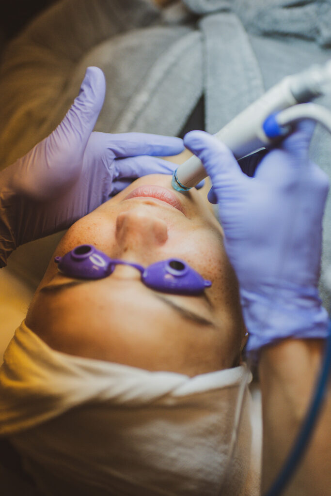 Woman receiving a HydraFacial® treatment at BodyLase