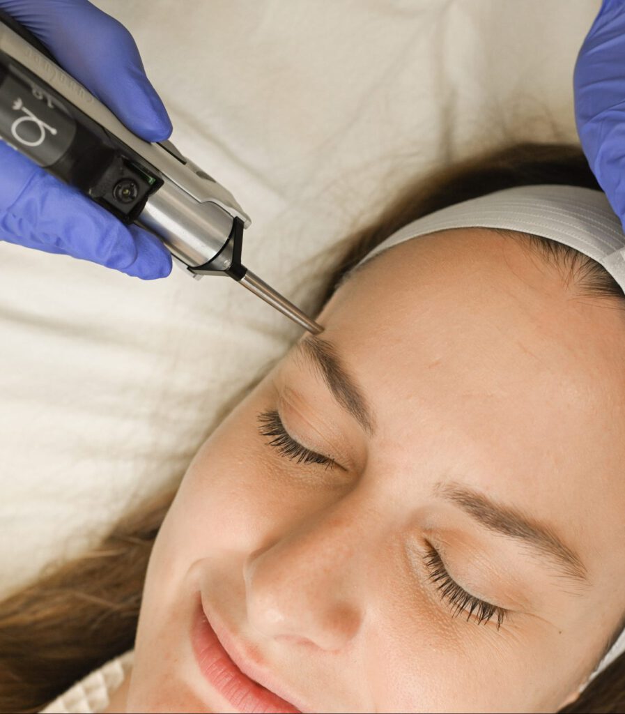 Woman receiving a Laser Facial at BodyLase