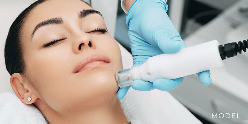 Microneedling