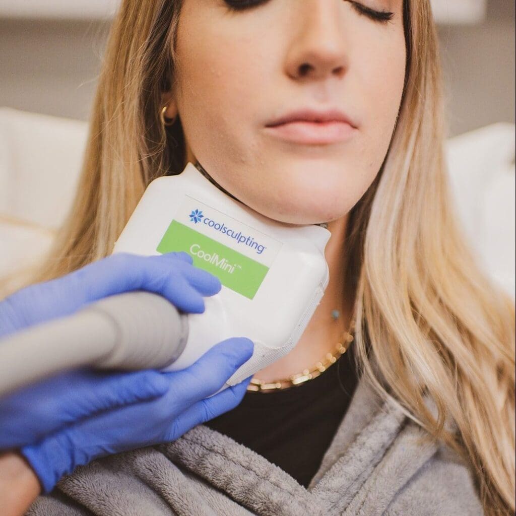 BodyLase CoolScultping treatment