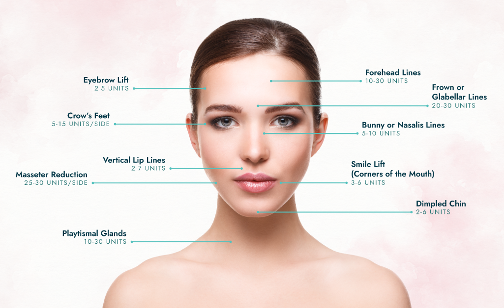 Areas and Average Units for Botox Injections