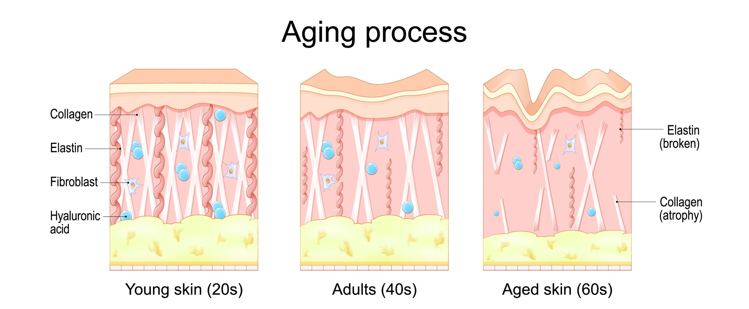 Aging Process Collagen Depletion