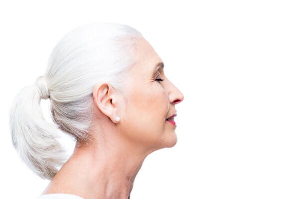 How Long Does Kybella Swelling Last?