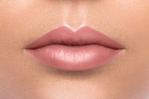 What to Expect After Lip Filler