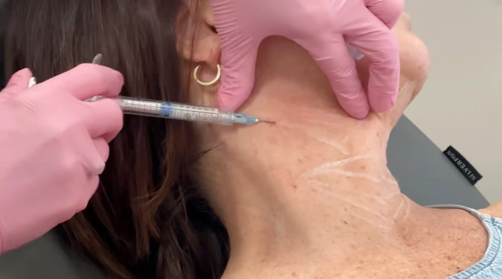 BodyLase® Med Spa - Hyperdilute Radiesse Dermal Filler Neck BodyLase