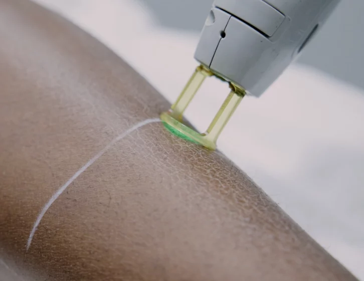 BodyLase® Med Spa - Laser Hair Removal Darker Skin 7 e1778861792472