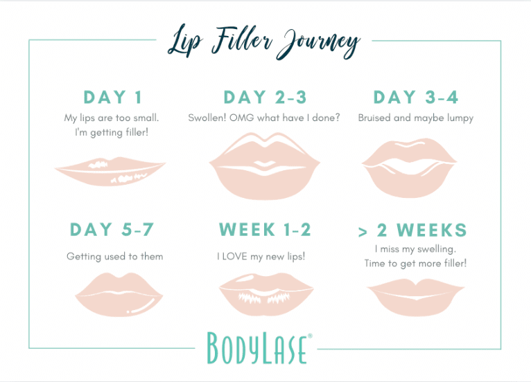 Lip Filler Aftercare
