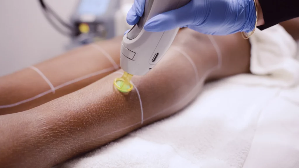 BodyLase® Med Spa - laser dark 1