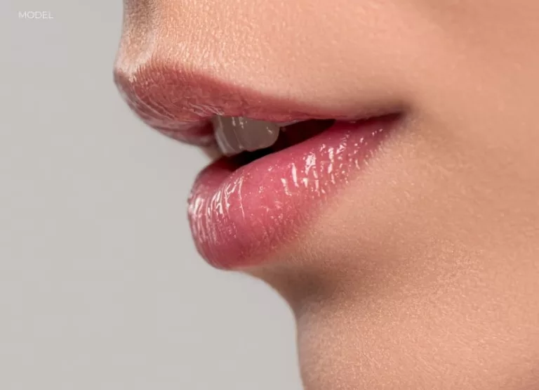 Lip Flip vs Filler