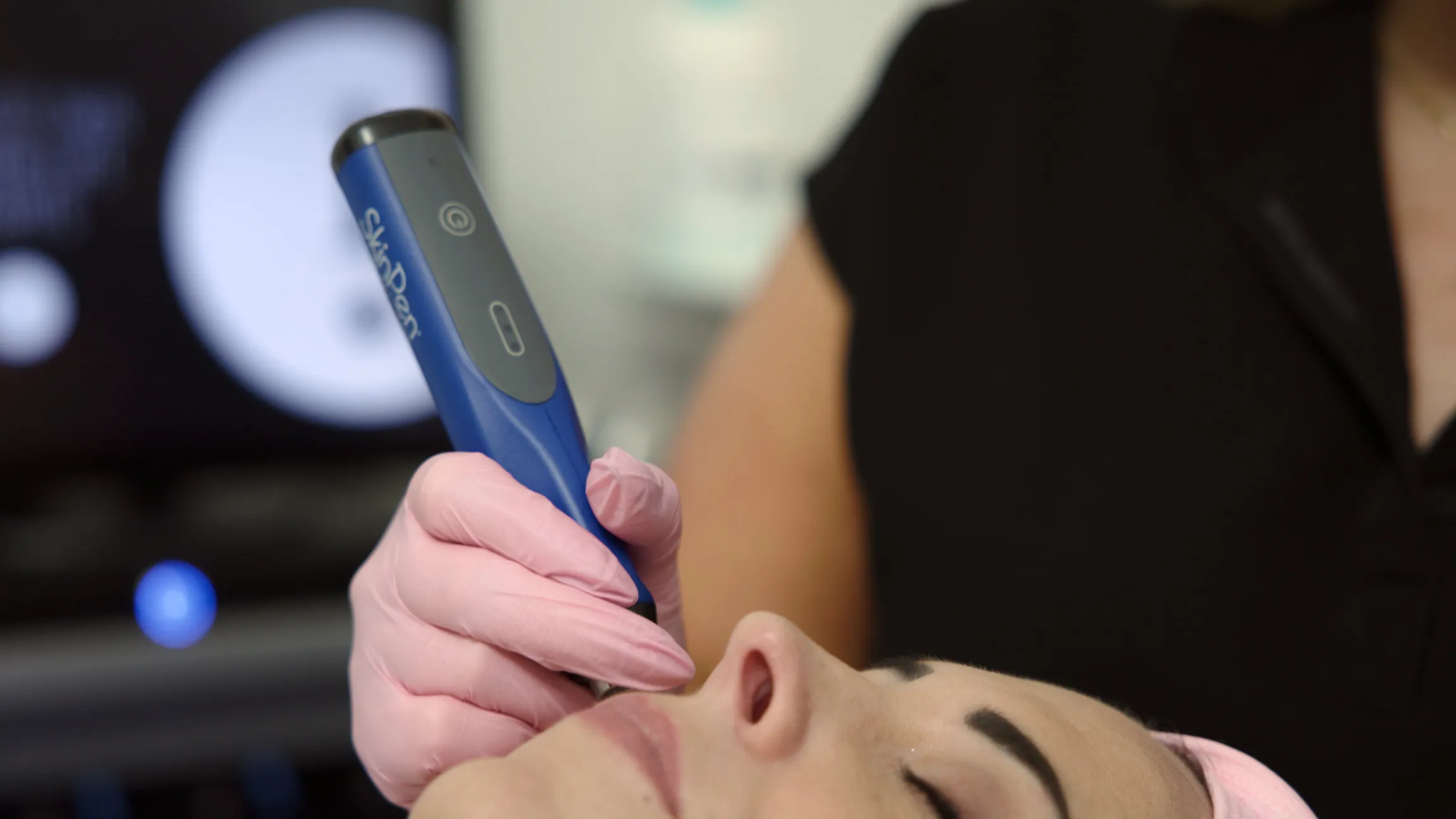 BodyLase® Med Spa - microneedling 3