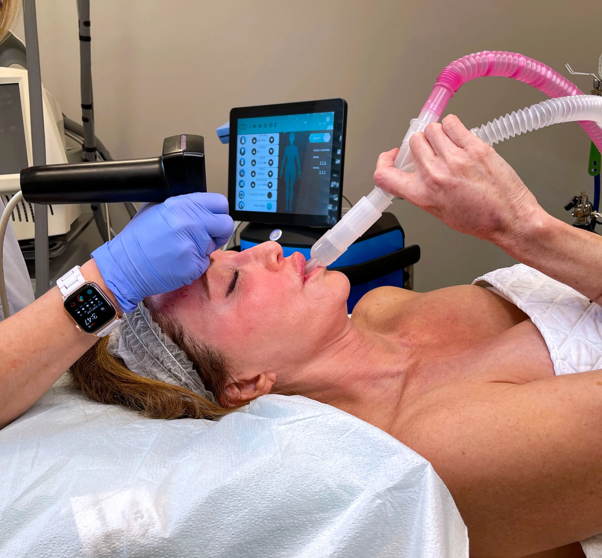 BodyLase® Med Spa - pronox 1 1 scaled