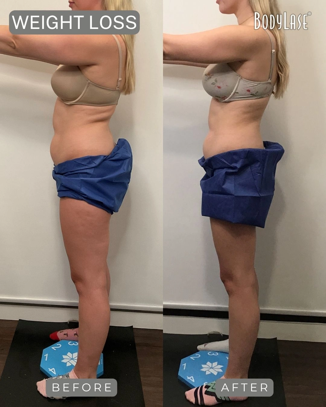 medrx pharmacy tirzepatide Unique Physique? : r/tirzepatidecompound