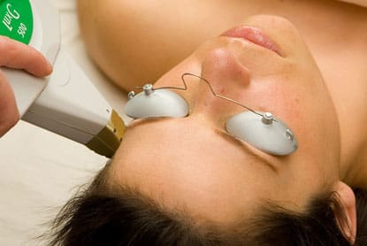 IPL for Sun Damage