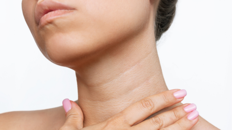 Tech Neck Is Making Headlines… Here’s What You Need to Know