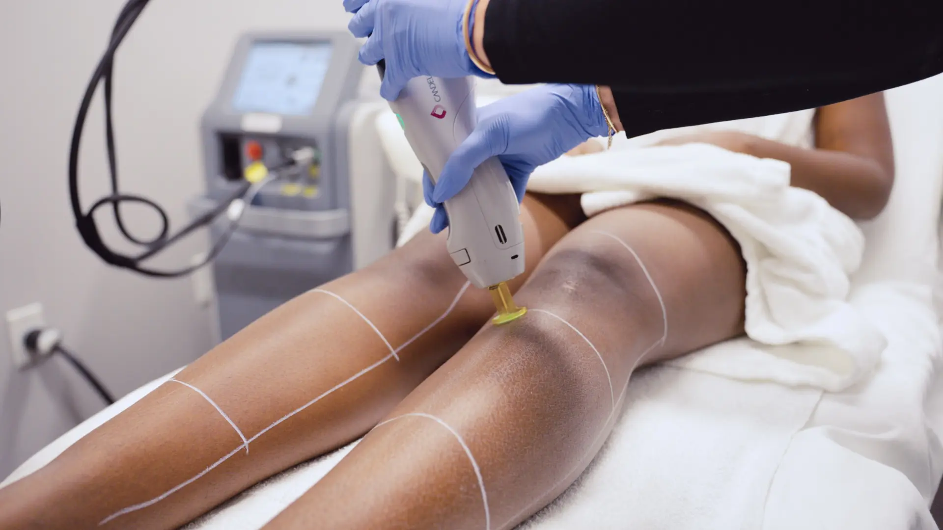 BodyLase® Med Spa - Sep26. Special Image 169 1